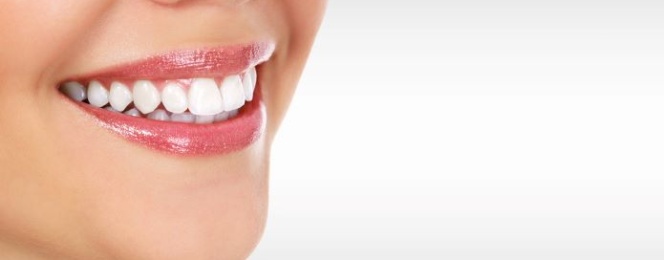woman with cosmetic dental work smiling showing her teeth whitening