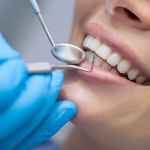 How to Protect Your Smile Investment in New Jersey