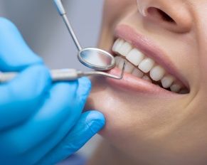 how to protect your smile investment in New Jersey