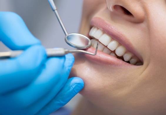 how to protect your smile investment in New Jersey