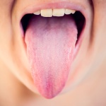 Tongue Thrust in Adults: The Silent Habit Affecting Your Teeth