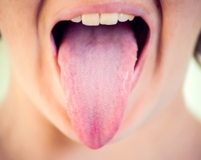 tongue thrust in adults