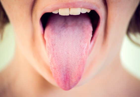 tongue thrust in adults