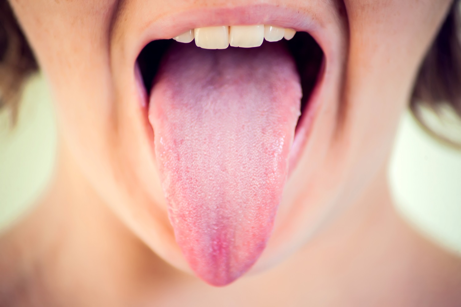 tongue thrust in adults