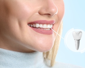 dental implants cost New Jersey