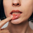Why Are My Gums Bleeding? The Causes You Should Know About