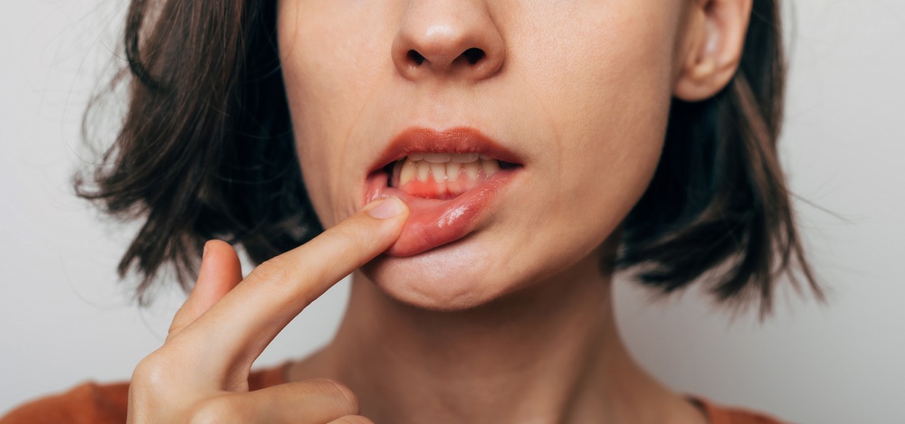 dental bleeding