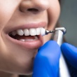 What Happens at a Professional Teeth Cleaning and Why You Should Not Skip It