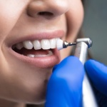 What Happens at a Professional Teeth Cleaning and Why You Should Not Skip It
