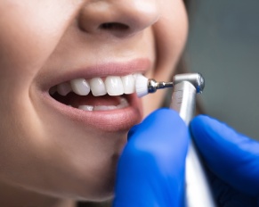 dental cleaning