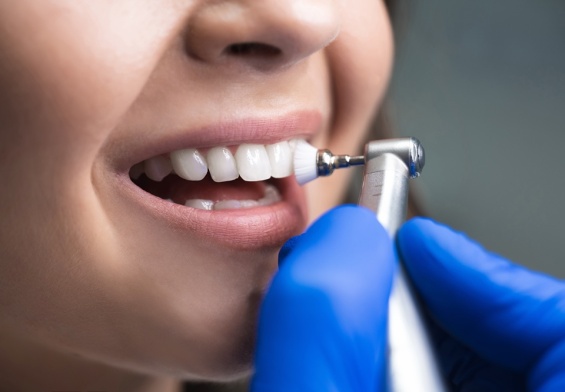 dental cleaning