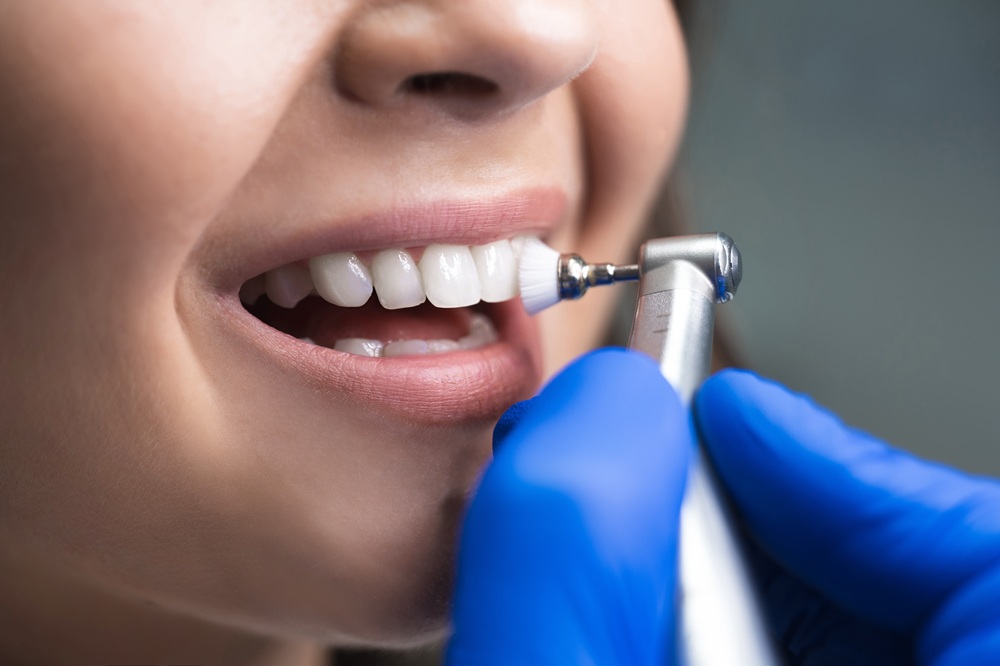dental cleaning
